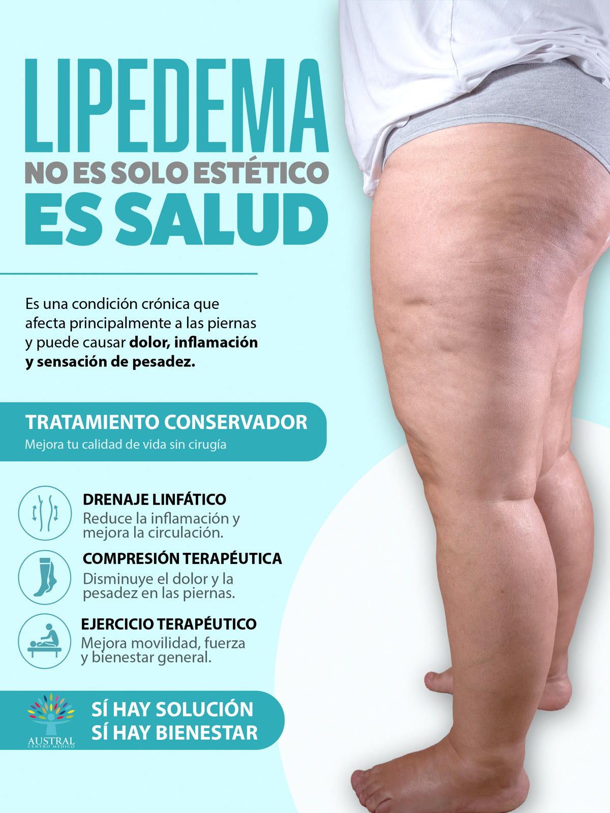 Tratamiento conservador para lipedema en Centro Médico Austral